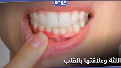 علامات تحذيرية غير معروفة موجودة في الفم قد تكشف أمراض القلب مبكراً