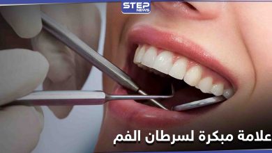 علامة بسيطة على الشفاه غير مبررة قد تكون دليل على الإصابة في سرطان الفم