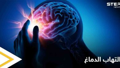 تعرف على مرض التهاب الدماغ ومخاطره الصحية وكيفية الوقاية منه