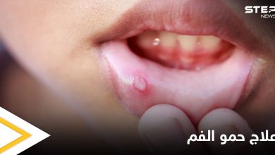 ما هي أسباب ظهور حمو الفم ومتى يكون خطيراً ويحتاج إلى التدخل الطبي إليك أهم المعلومات