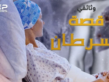 مرض السرطان.. في يومه العالمي ما هي قصة ظهوره قبل آلاف الأعوام وحتى الآن