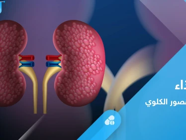 القصور الكلوي.. إليك النظام الغذائي الأمثل لتجنب تفاقم المرض