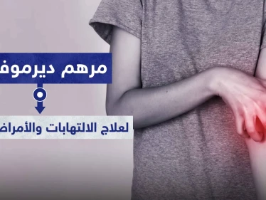 مرهم ديرموفيت Dermovate لعلاج الالتهابات والأمراض الجلدية