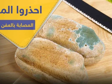 احذروا تناول المواد الغذائية المصابة بالعفن.. خبيرة تعذية تكشف الأسباب