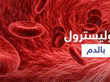 "تصيب الساق ويمكن أن تكون خطيرة".. أول علامة لارتفاع نسبة الكوليسترول