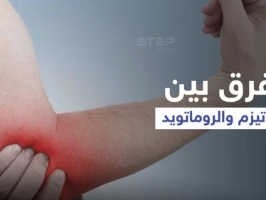 الفرق بين الروماتيزم والروماتويد.. إليك أهم المعلومات
