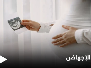 "نبض الجنين".. ولاية تكساس تتخذ قراراً مصيرياً يخص الإجهاض