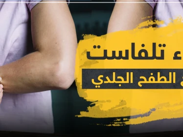 دواء تلفاست لعلاج الطفح الجلدي