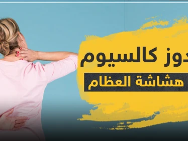 دواء sandoz ساندوز كالسيوم لعلاج هشاشة العظام