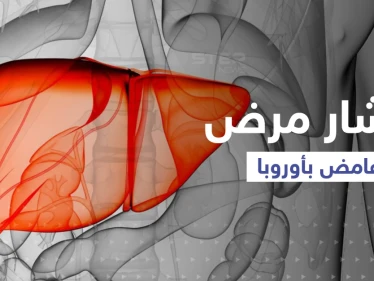 مرض غامض بالكبد يصيب أطفالاً في 12 بلداً.."الصحة العالمية" تعرض الإحصاءات !