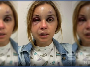 بالفيديو|| مذيعة أوكرانية تعرضت لضرب عنيف ومحاولة "اغتصاب" وتكشف كيف تمكنت من الهرب