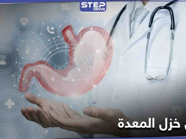 ما هو مرض خزل المعدة وكيف يعطل عمل الجهاز الهضمي وأسبابه وطرق العلاج