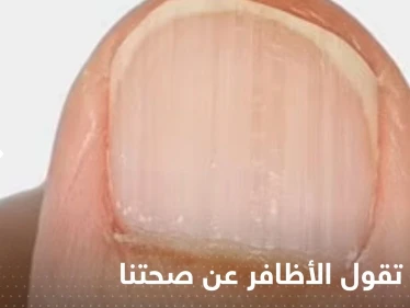 ماذا تقول الأظافر عن صحتنا؟.. تعرف على الحالات الخطيرة