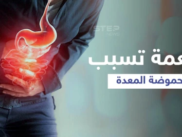 تعرّف على الأطعمة والمشروبات التي تسبب الحموضة في المعدة وأخرى تعالجها