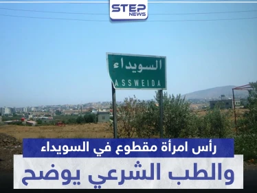 في حادثة يلفها الغموض.. رأس امرأة مقطوع في السويداء والطب الشرعي يوضح