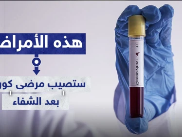دراسة تكشف الأمراض التي ستصيب مرضى "كورونا" بعد الشفاء من الفيروس