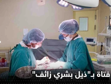 شاهد|| بظاهرة نادرة للغاية.. ولادة فتاة في البرازيل بـ"ذيل بشري زائف"