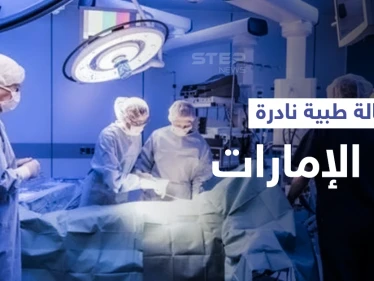 في حالة طبية نادرة... إماراتية ظنت أنها مريضة سرطان لتكتشف أنها تمتلك "طحالين" والطبيب يوضح