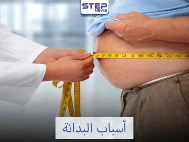 تعرف على أسباب البدانة