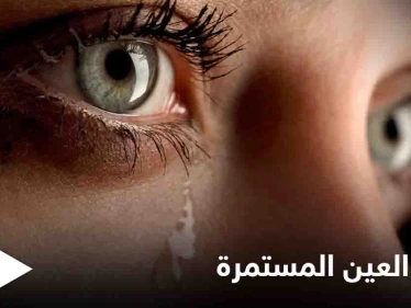 تعرف على أسباب دموع العين المستمرة وطرق علاجها