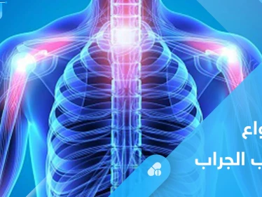 التهاب الجراب وآلام المفاصل.. كل ما عليك معرفته