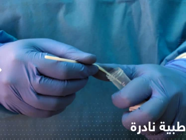 الإعلان لأول مرة عن شخص مصاب بكورونا والإيدز وجدري القردة معاً