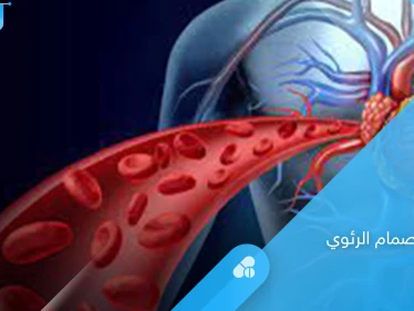 خطورة ضيق الصمام الرئوي وطرق العلاج.. إليك أهم المعلومات