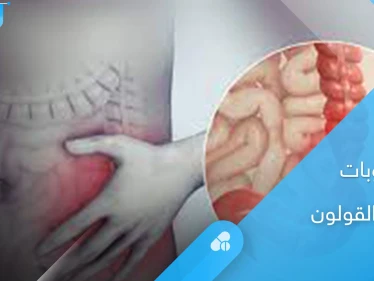 دور السوائل والمشروبات في علاج آلام القولون والأكثر فائدة بينها