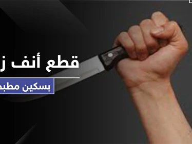 "قطع أنفها بالسكين".. رجل يعتدي على زوجته خلال الحظر لطلبها هذا الأمر