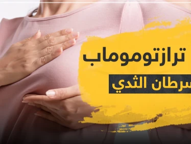 دواء ترازتوموماب لسرطان الثدي
