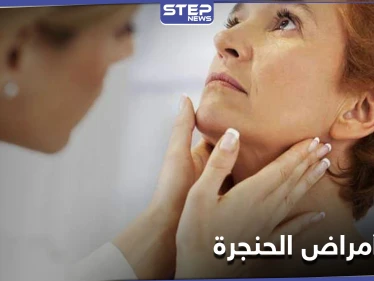كيف تتجنب أمراض الحنجرة وآلامها الحادة وما أفضل طرق العلاج
