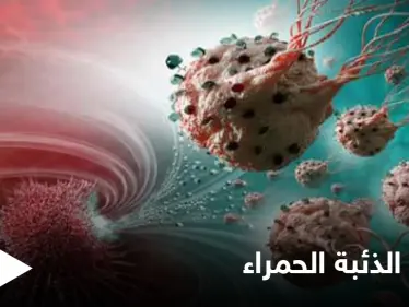 في الشهر العالمي لمكافحته.. تعرف على مرض الذئبة الحمراء وخطورته وأنواعه الشائعة - وكالة ستيب نيوز