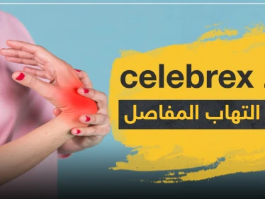 دواء celebrex لعلاج التهاب المفاصل