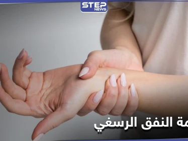 من أكثر الأمراض الشائعة.. متلازمة النفق الرسغي تعرف إلى أعراضها وطرق العلاج