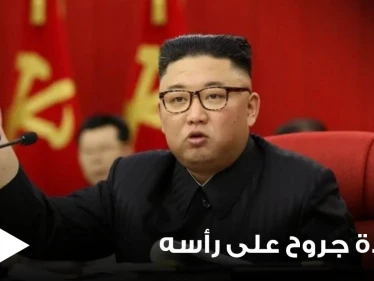 شاهد|| كدمة وضمادة جروح على رأسه.. زعيم كوريا الشمالية يثير الجدل بظهوره الأخير