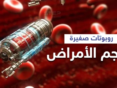 لعلاج السرطان والأمراض المستعصية..روبوتات مرنة تدخل جسم الإنسان وتهاجم الإصابة إليك التفاصيل
