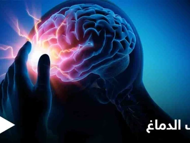 تعرف على مرض التهاب الدماغ ومخاطره الصحية وكيفية الوقاية منه