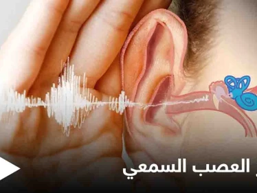 تعرف على مرض ضمور العصب السمعي أسبابه وأعراضه وطرق العلاج