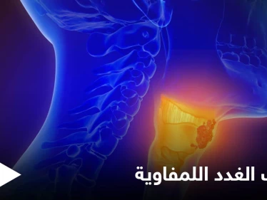 أسباب التهاب الغدد اللمفاوية و أهم طرق علاجها في المنزل
