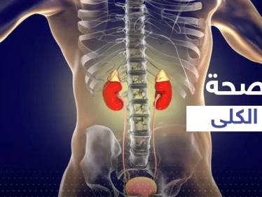 4 مشروبات شهيرة الإفراط في تناولها يضر بكليتك ويسبب تلفها.. احذر منها
