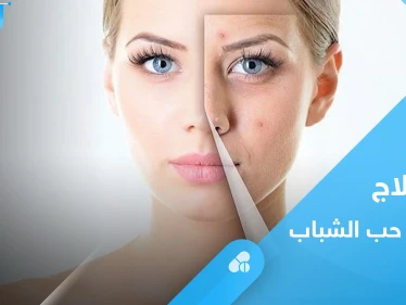 متى يترك حب الشباب ندباً وما الطريقة الأفضل لعلاجه.. إليك رأي الخبراء