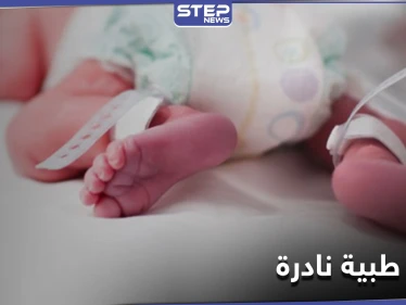 حالة طبية نادرة في بريطانيا.. أم تلد ثلاثة أطفال من رحمين مختلفين في آن واحد