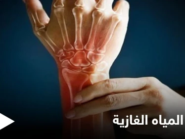 منها تعزيز صحة العظام.. تعرف على فوائد المياه الغازية ومضارها الجانبية