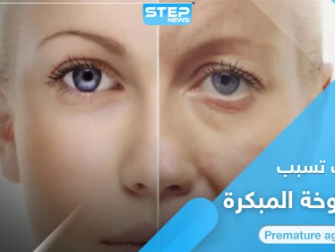 هل لديك علامات الشيخوخة المبكرة.. إليك 8 أنواع من المأكولات ابتعد عنها فوراً