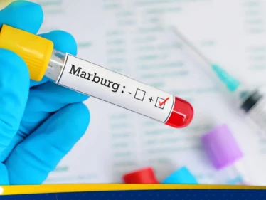 مصر تتأهب لفيروس خطير محتمل قادم من إثيوبيا - وكالة ستيب نيوز