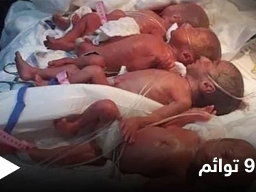 شاهد بالصور|| في حالة نادرة.. ولادة 9 أطفال من أم واحدة تتطلب تدخل السلطات