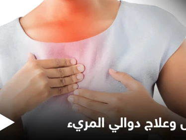 ما هي دوالي المريء وأعراضها وطرق علاجها إليك أهم المعلومات