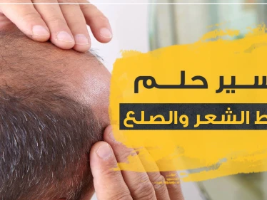 تفسير حلم تساقط الشعر والصلع بحسب ابن سيرين للحامل والمتزوجة والعزباء