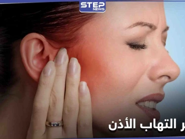 مخاطر التهاب الأذن ومتى يكون قاتلاً.. تعرف إلى الأعراض غير المتوقعة