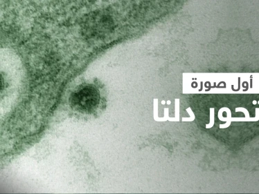 شاهد مجهر إلكتروني يلتقط أول صورة لـ متحور دلتا ينمو كخلايا القرد الأفريقي (صورة)